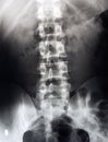 Lumbar spine x-ray, lower back Royalty Free Stock Photo