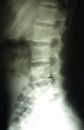 Lumbar spine x-ray, lower back Royalty Free Stock Photo