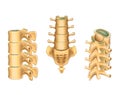 Lumbar vertebrae and sacrum