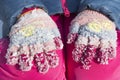 Lumps of frozen snow on woolen gloves