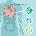 Lung with bacterial lung infection