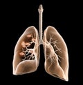 Lung cancer or bronchial carcinoma, medically 3D illustration