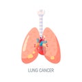 Lung cancer vector concept in flat style