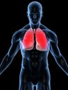 Lung infection Royalty Free Stock Photo