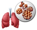 Lung Pulmonari Alveoli Royalty Free Stock Photo