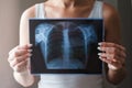 Lung radiography concept. Virus and bacteria infected the Human lungs. Patient with Lung Cancer or Pneumonia. Royalty Free Stock Photo