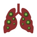 Lung settled covid - 19, corona virus disease