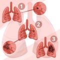 Lung system infographic, cartoon style