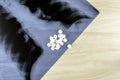 Lung X-ray blister with pills on the table with copyspace Royalty Free Stock Photo