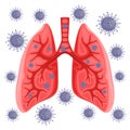 Lungs infected with virus.