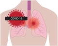 Lungs affected with coronavirus infection COVID19