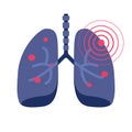 Lungs cancer illness or lung pneumonia and bronchitis tuberculosis pulmonary disease vector flat icon illustration