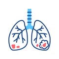 Lungs cancer line color icon. Human organ concept. Malignant neoplasm. Sign for web page, mobile app, button, logo