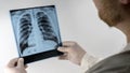 Lungs of a healthy person in the picture  an x-ray of a person's lungs in the hands of a doctor Royalty Free Stock Photo