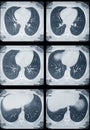 Lungs and heart tomography Royalty Free Stock Photo