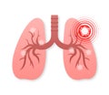 Lungs pain. Vector illustration icon. Isolated vector illustration.Medical icon.