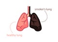 Lungs smoker and healthy person. Wholesome pink organ and blackened from tobacco.