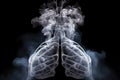 Lungs of a Smoker, Generative AI Royalty Free Stock Photo