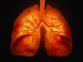 Lungs with visible bronchi