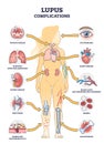 Lupus erythematosus medical autoimmune disease complications outline diagram Royalty Free Stock Photo