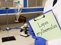 Lupus erythematosus is shown on the conceptual medical photo Royalty Free Stock Photo