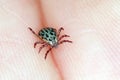 Lyme disease-carrier Ixodes tick Dermacentor marginatus on human skin.