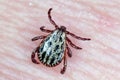 Lyme disease-carrier Ixodes tick Dermacentor marginatus on human skin.