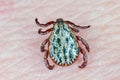 Lyme disease-carrier Ixodes tick Dermacentor marginatus on human skin. Royalty Free Stock Photo