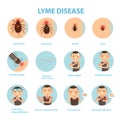 Lyme disease