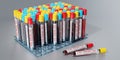 Lyme disease virus - test tubes, blood tests - 3D illustration