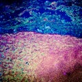 Lymph gland tissue