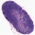 Lymph node