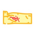 lymph node dissection surgery color icon vector illustration