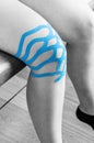 Lymphatic knee technique, two fan strips. Kinesiology Tape in si Royalty Free Stock Photo