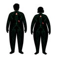 Lymphatic system in obese body