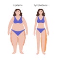 Lymphedema and lipedema