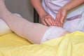 Lymphedema management: Wrapping leg using multilayer bandages to control Lymphedema. Part of complete decongestive therapy cdt a