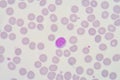 Lymphocyte Royalty Free Stock Photo