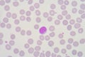 Lymphocyte