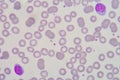 Lymphocyte