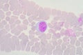 Lymphocyte