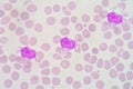 Lymphocyte Royalty Free Stock Photo
