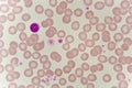 Lymphocyte cell in blood smear