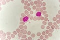 Lymphocyte cell in blood smear