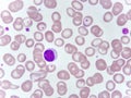 Lymphocyte cell in blood smear