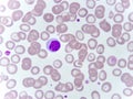 Lymphocyte cell in blood smear