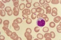 Lymphocyte cell in blood smear