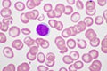 Lymphocyte cell in human blood smear