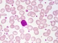 Lymphocyte cell Royalty Free Stock Photo