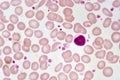 Lymphocyte cell Royalty Free Stock Photo